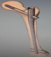 731975